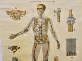 Large University Anatomical Chart “Ligamnets” By Turner photo Art